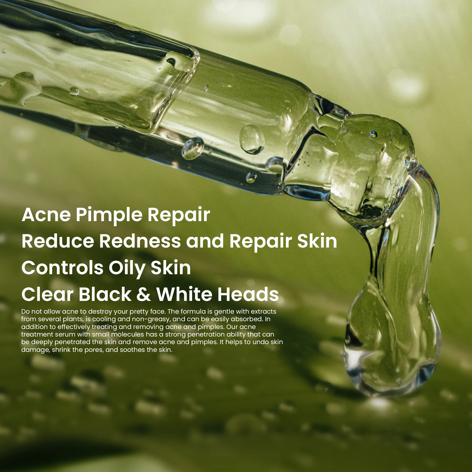Acne Treatment Face Serum 30ml - Image 3